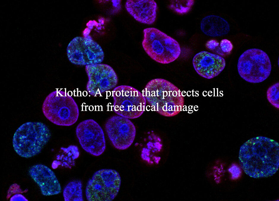 Klotho: A protein that protects cells from free radical damage